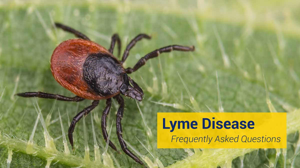 Frequently Asked Questions (FAQs) Johns Hopkins Medicine Lyme Disease